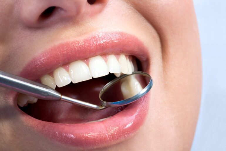 Importance of Post-Orthodontic Care